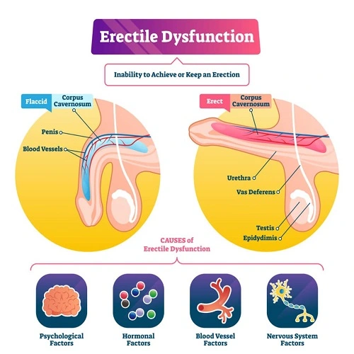 Erectile Dysfunction Symptoms