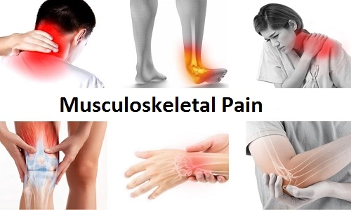 Musculoskeletal Pain