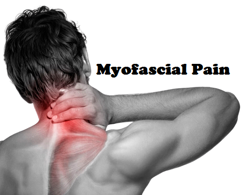 Myofascial Pain