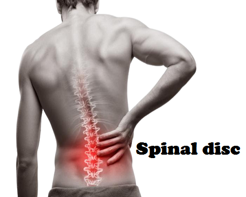 Spinal disc Pain