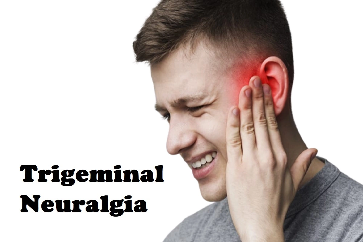 Trigeminal Neuralgia Causes, Symptoms and Treatment