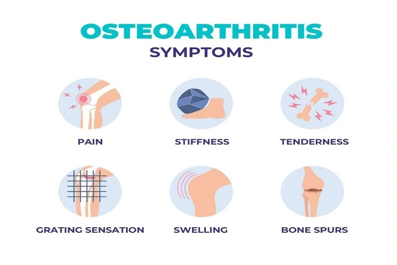Osteoarthritis Symptoms