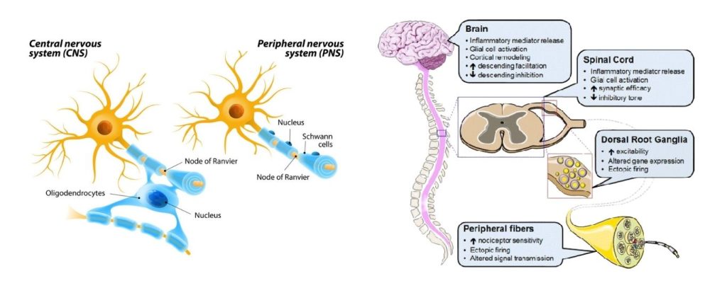 Nerve Pain fig 1