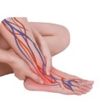 Peripheral Neuropathy