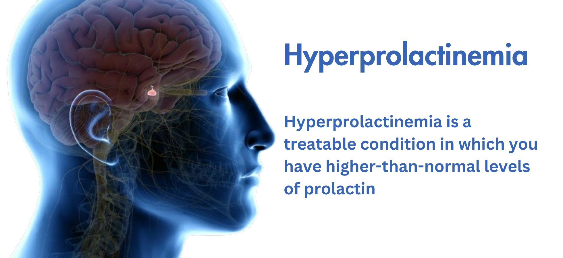 Hyperprolactinemia: Symptoms, and Management Strategies